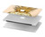 S3490 Gold Pineapple Hard Case For MacBook 12″ - A1534