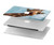 S3680 Cute Smile Giraffe Hard Case For MacBook 12″ - A1534