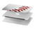 S1842 New Baseball Hard Case For MacBook Air 13″ - A1932, A2179, A2337