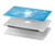 S2923 Frozen Snow Spell Magic Hard Case For MacBook Pro Retina 13″ - A1425, A1502