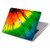 S3422 Tie Dye Hard Case For MacBook Pro Retina 13″ - A1425, A1502