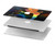 S2583 Tinkerbell Magic Sparkle Hard Case For MacBook Pro 15″ - A1707, A1990
