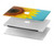 S3039 Vintage Sunflower Blue Hard Case For MacBook Pro 15″ - A1707, A1990