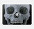 S1286 Diamond Skull Hard Case For MacBook Pro 16″ - A2141