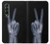 S3101 X-ray Peace Sign Fingers Case For Samsung Galaxy Z Fold 3 5G