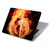 S0493 Music Note Burn Hard Case For MacBook Pro 14 M1,M2,M3 (2021,2023) - A2442, A2779, A2992, A2918