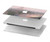 S1443 Terrace in Paris Eifel Hard Case For MacBook Pro 14 M1,M2,M3 (2021,2023) - A2442, A2779, A2992, A2918