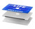 S3136 Life in the Fast Lane Swimming Pool Hard Case For MacBook Pro 14 M1,M2,M3 (2021,2023) - A2442, A2779, A2992, A2918