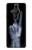S3101 X-ray Peace Sign Fingers Case For Sony Xperia Pro-I