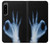 S3239 X-Ray Hand Sign OK Case For Sony Xperia 5 IV