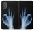 S3239 X-Ray Hand Sign OK Case For Motorola Moto G Power 2022, G Play 2023