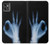 S3239 X-Ray Hand Sign OK Case For Motorola Moto G32