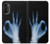 S3239 X-Ray Hand Sign OK Case For Motorola Moto G52, G82 5G