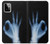 S3239 X-Ray Hand Sign OK Case For Motorola Moto G Power (2023) 5G