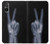 S3101 X-ray Peace Sign Fingers Case For Sony Xperia 5 V