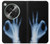 S3239 X-Ray Hand Sign OK Case For OnePlus OPEN