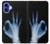 S3239 X-Ray Hand Sign OK Case For iPhone 16