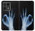 S3239 X-Ray Hand Sign OK Case For Motorola Edge 50 Ultra
