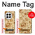 S2180 Flower Floral Vintage Pattern Case For OnePlus 13