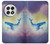 S3802 Dream Whale Pastel Fantasy Case For OnePlus 13