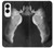 S1593 Ballet Pointe Shoe Case For Samsung Galaxy S25 Edge