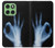 S3239 X-Ray Hand Sign OK Case For Motorola Edge 60
