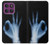 S3239 X-Ray Hand Sign OK Case For Motorola Edge 60 Pro