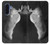 S1593 Ballet Pointe Shoe Case For Samsung Galaxy A17