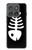 S2509 Fishbone Case For Motorola Edge (2025)
