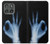 S3239 X-Ray Hand Sign OK Case For Motorola Edge (2025)