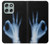 S3239 X-Ray Hand Sign OK Case For Motorola Moto G56