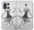 S1432 Skull Octopus X-ray Case For OnePlus 15