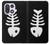 S2509 Fishbone Case For OnePlus 15