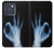 S3239 X-Ray Hand Sign OK Case For Motorola Edge 70