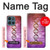 S2573 Dna Genetic Code Case For Motorola Moto G (2026), G Play (2026)