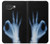 S3239 X-Ray Hand Sign OK Case For Google Pixel 10a