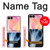 S3239 X-Ray Hand Sign OK Case For Samsung Galaxy Z Flip 8