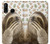 S3559 Sloth Pattern Case For Huawei P30 lite