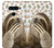 S3559 Sloth Pattern Case For LG V40, LG V40 ThinQ