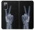 S3101 X-ray Peace Sign Fingers Case For Samsung Galaxy S20 FE
