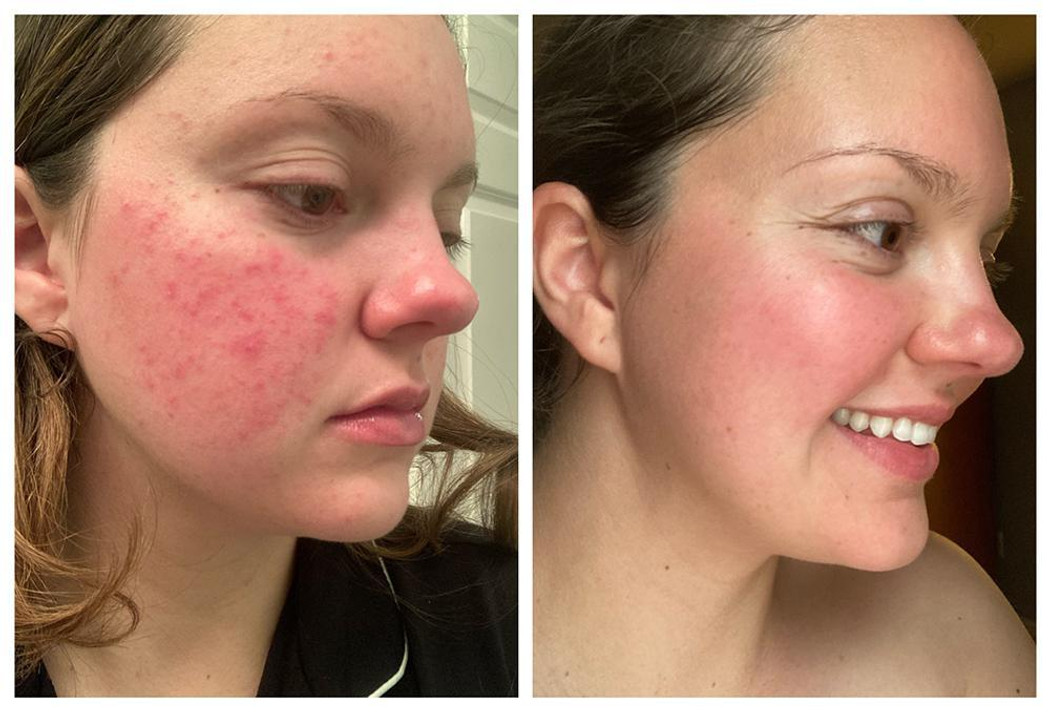 Restore - Omega Miracle Facial Oil Restore - Omega Miracle Facial Oil