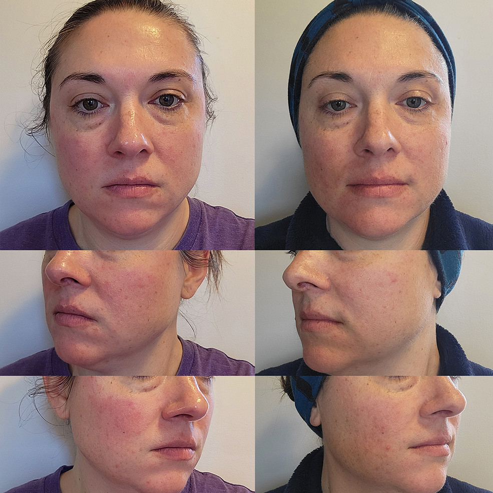 Pure - Sensitive Care Complex