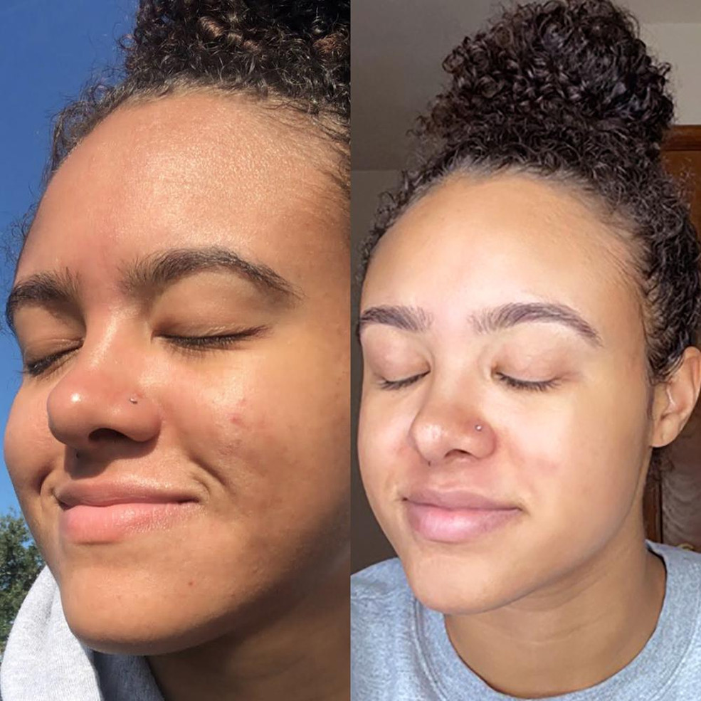 Refine - Clay Renewal Treatment Refine - Clay Renewal Treatment