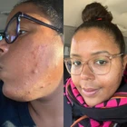 Fresh - Mild Rice Facial Cleanser