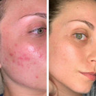 Smooth A+ Correcting Serum