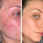 Smooth A+ Correcting Serum
