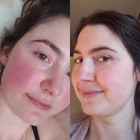 Pure - Sensitive Care Complex