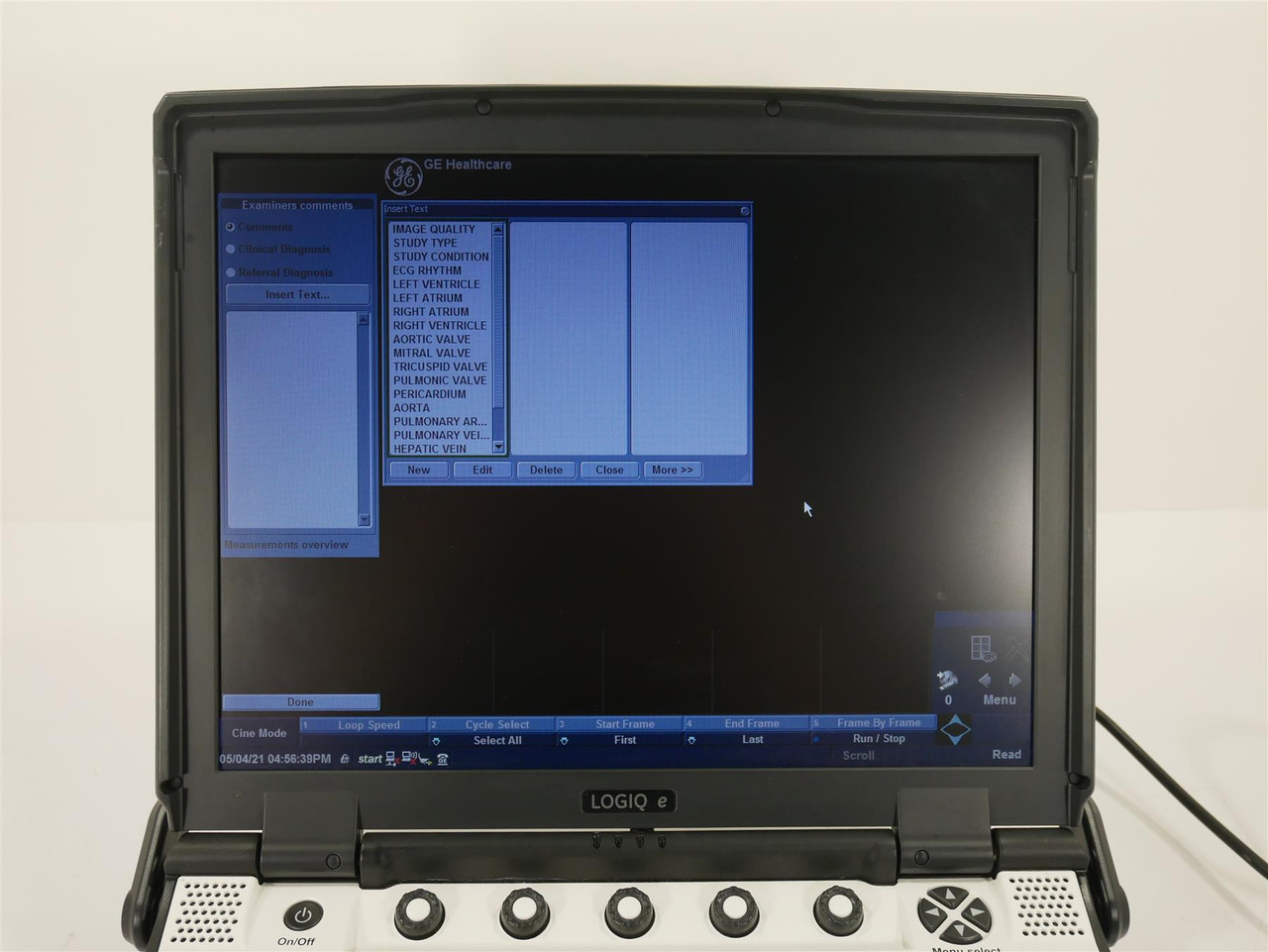 GE logiq e portable ultrasound System -Free Shipping