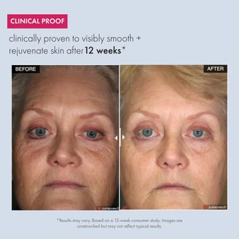 Before-and-after front-facing images showing visibly smoother skin with reduced fine lines and wrinkles, and a more rejuvenated, even-looking complexion after 12 weeks of use.