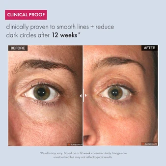 Before-and-after close-up of the under-eye area showing smoother skin, reduced fine lines, and visibly diminished dark circles after 12 weeks of use.